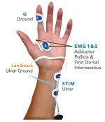ElectrodePlacement_Large_Hand-v1b